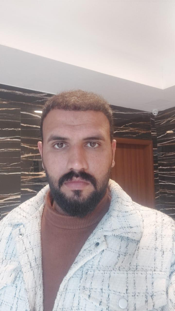 💰 السعر يبدأ من 650 - 850 الف حسب مساحة الصلع 
🔴 العملية تُجرى على يد كادر طبي مختص (وليس خبير)

حفاظاً على صحتكم نستخدم احدث التقنيات 
❇️ الزرع بتقنية حجر الزفير (حصريًا)
❇️ و القطف بتقنية الاقتطاف FUE الأحدث عالميًا

🔹 زراعة 6D و3D
🔹 للرجال والنساء
🔹 تشمل:
 • زراعة شعر الرأس
 • اللحية،شارب 
 • الحواجب
 • الحروق والندوب

⚡️ مدة العملية: لا تتجاوز 8 ساعات
⚡️ عدد البصيلات مفتوح دون الضرر بالمانحة 
⚡️ التخدير: موضعي وبدون ألم ✔️

⸻

🎁 يشمل العرض مجانًا:

✅ المعاينة والفحوصات قبل العملية 🔬🧪
✅ 8 جلسات بلازما (منشأ إيطالي) 💉
✅ 8 جلسات ميزوثيرابي (إسباني – فيتامينات، أحماض، معادن) 💉
✅ غسل الشعر يوميًا بعد الزراعة
✅ حقيبة علاجية متكاملة بعد العملية 💊
✅ وجبة طعام للمريض 🍔
✅ شهادة ضمان مدى الحياة
✅ شامبو طبي
✅جلستين نضارة للبشرة
⸻

مرحباً استاذ 💟
للاستفسار مع مختصين زراعة الشعر في مركزنا عبر واتس اب يرجى الضغط هنا 👈🏻 https://wa.me/9647772044099


**إذا كنت صاحب هذا الإعلان وتريد حذفه لأي سبب، رجاءا أرسل رسالة إلى الدعم الفني**