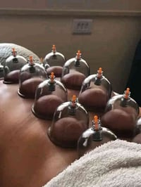 حجامة ٨-١٠-١٢ ديسمبر • وفق السنّة • حي العسكري شارع حلوة