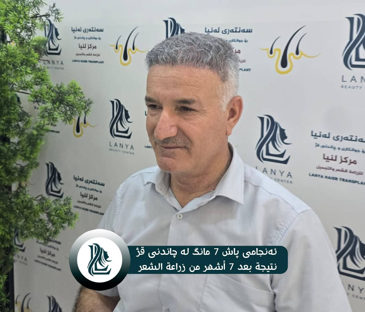 "لأن شعرك سر جاذبيتك، أعد له الحياة مع خبراء لـنـيـا."
🔹 نتائج زراعة الشعر ممیز والفريدة من نوعها تظهر دائمًا في مركز لەنیا .
♦  مع لەنیا حافظ على شبابك.
📍 العنوان:كلار - شارع ليوا - قرب جامع بخاري
📞 رقم التواصل:
***********
🔸🔸🔸🔸🔸🔸🔸🔸🔸🔸🔸🔸🔸🔸
🌿قژی چڕتر، ڕووخسارێکی جوانتر 🌿
چاندنی قژ لە لەنیا، هەنگاوێک بۆ دڵنیایی و جوانی زیاتر.
🔹 ئەنجامی چاندنەوەی قژی بێ وێنە و ناوازە هەموو کات لە سەنتەری لەنیا دەبینرێت 
♦ لەگەڵ لەنیا هەمیشە بەگەنجی دەمێنێتەوە 
📍  ناونیشان: کەلار- شەقامى لیواکە - نزیک مزگەوتی بوخاری
📞  ژمارەی پەیوەندی: ***********

