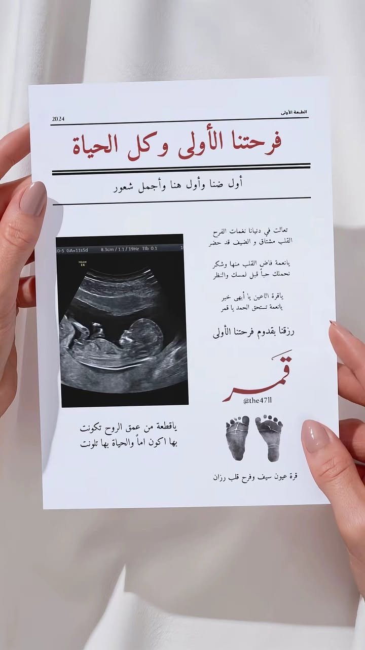 استيكرات لتصوير جلسه حمل وبيبي حسب طلب
للحجز والأستفسار مراسلة الخاص او الواتس اب
***********
توصيل جميع محافظات العراق
#اكسبلور #اللهم_صلي_على_نبينا_محمد #تصوير_جلسة_حمل #تصاميم_دودو_اليدوية #dudu_works
