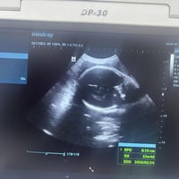 متابعة أم وطفل • د.انجي سعيد • مجمع الحياة الطبي