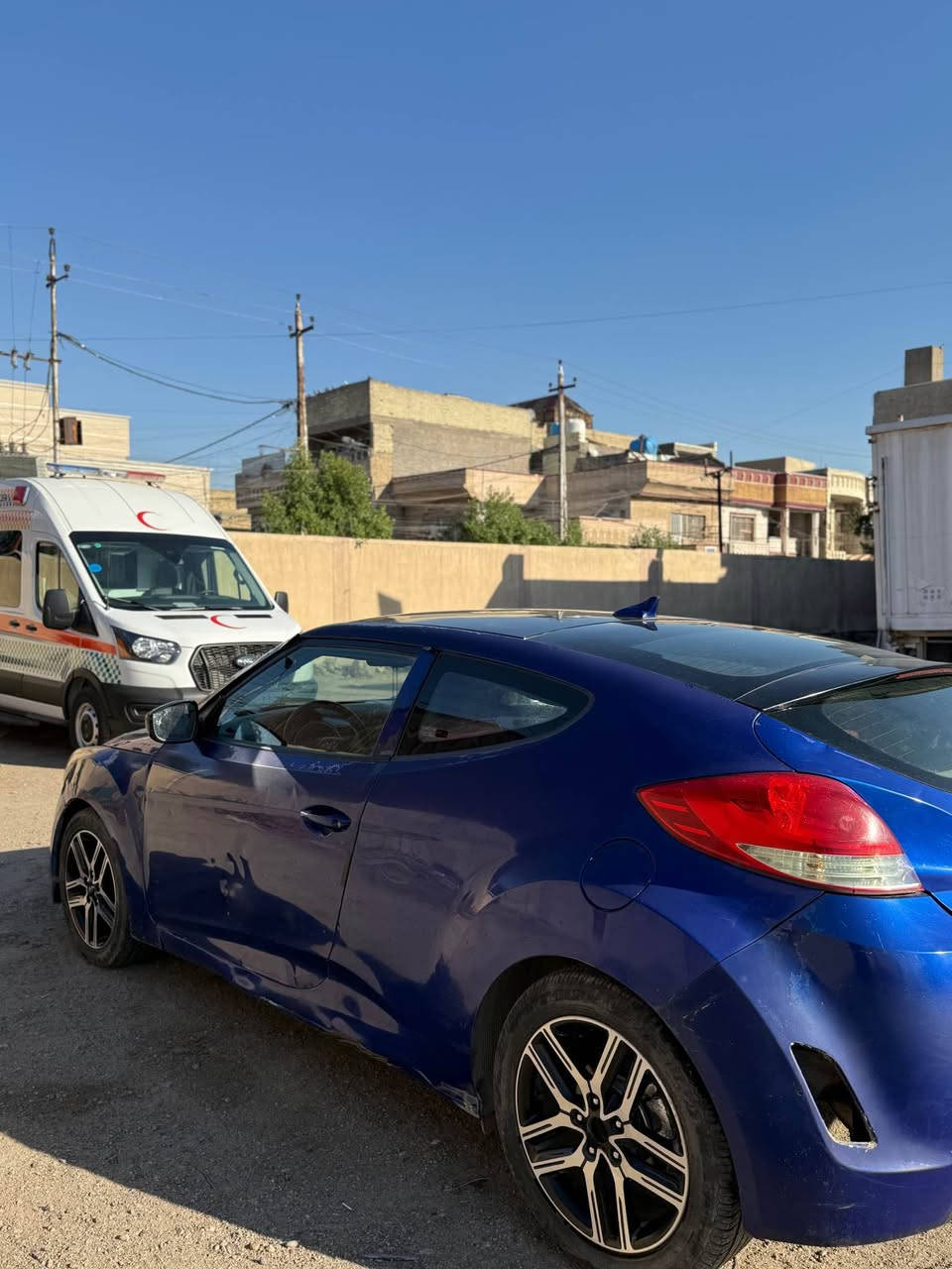 السلام عليكم 
للبيع هونداي فولستر ٢٠١٣ 
مواصفات عاديه 
بيها قطع صبغ وطخات خفيفه اني ابيع حزام  السياره باسمي تحويل ثاني يوم 
رايدها ب٧٥ وبيها مجال 
مكان السياره بغداد 
*********** بغداد, العراق
