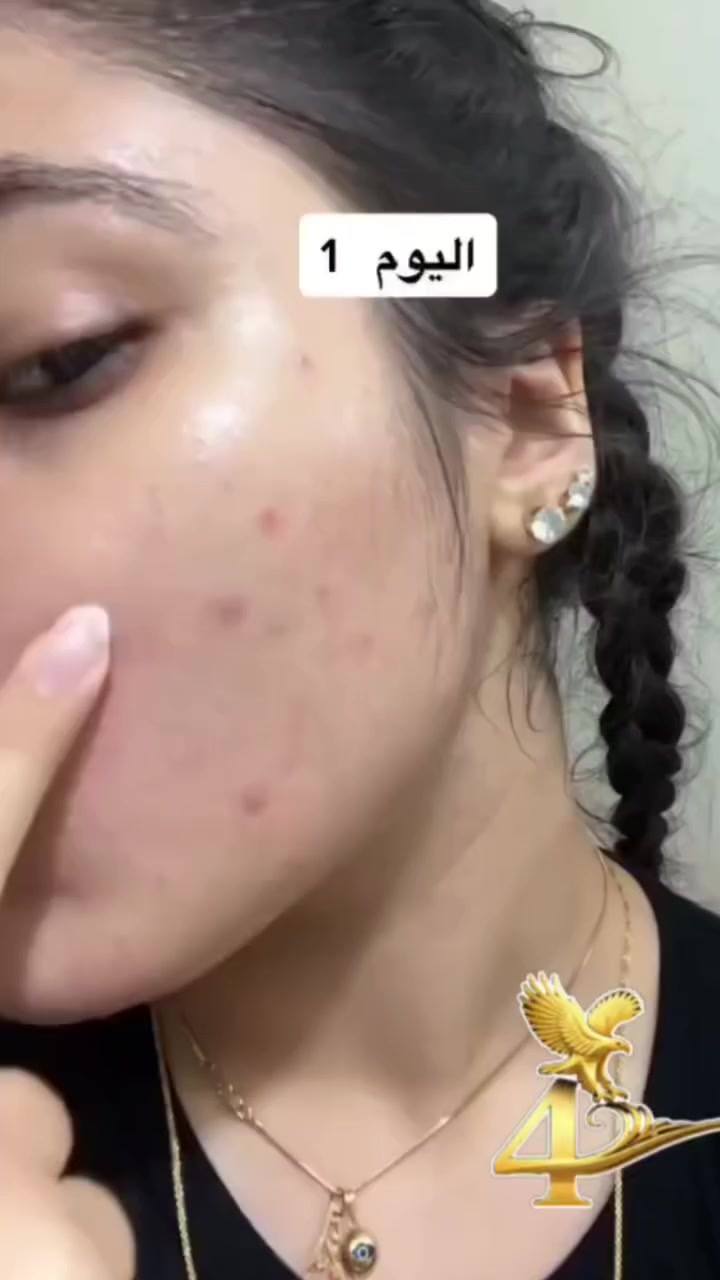 ✨ بشرتچ تستاهل الدلال ✨
إذا تعبتي من البهتان والحبوب وعدم النضارة، هذا المنتج راح يرجع لبشرتچ إشراقتها الطبيعية 💆🏻‍♀️💖
ترطيب عميق، تفتيح لطيف، ولمعان صحي من أول استخدام 🌸


**إذا كنت صاحب هذا الإعلان وتريد حذفه لأي سبب، رجاءا أرسل رسالة إلى الدعم الفني**