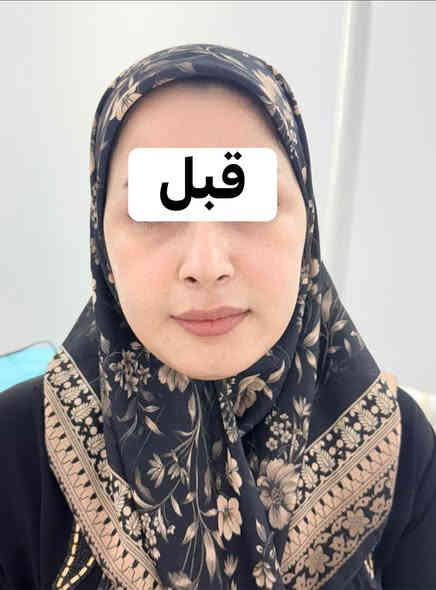 تغير شامل لعروستنه + فلر شفة +مكس الvip للنضارة😍😍
للحجز والاستفسار/***********
