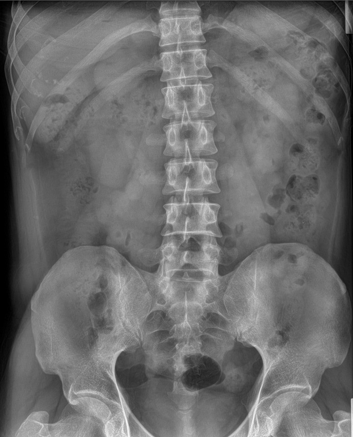 🏥✨ مكتب الجوهرة للأجهزة الطبية ✨🏥

📢 متوفر لدينا الآن

🔹 مستقبل الأشعة الرقمي (DR Detector)
🔹 نوع SHOW IMAGE
🔹 أجهزة جديدة بالكامل (غير مستعملة)

⭐ المواصفات والمزايا:
✅ Wireless – اتصال لاسلكي كامل
✅ AED (Automatic Exposure Detection) – الكشف التلقائي عن التعريض
✅ مقاس 17 × 17 إنش
✅ مقاوم للماء والغبار بمعيار IP65
✅ سرعة عالية في نقل واستقبال الصور
✅ جودة تصوير استثنائية ودقة تشخيصية عالية
✅ متوافق مع مختلف أنظمة الأشعة الرقمية

🏅 شهادات الجودة العالمية:
✔ FDA Certification
✔ CE Certification
✔ ISO Certification

📦 المحتويات:
• Flat Panel Detector
• Access Point
• Adapter + Charger + بطارية اضافية
• جميع الكيبلات والملحقات الأصلية
• برنامج تشغيل متكامل

🛡 ضمان حقيقي لمدة 3 سنوات
🚚 الشحن والتركيب والتدريب متوفر
🛠 دعم فني وخدمة ما بعد البيع

📞 للتواصل والاستفسار:
0770 285 5535

0770 347 4472

0771 172 9698

📍 مكتب الجوهرة للأجهزة الطبية
ثقتكم مصدر نجاحنا
