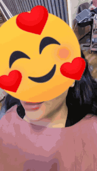 عرض  لمدة يومين تغير شامل 300❤️🤩 يشمل فيلر شفه✅️  وبتوكس ✅️ وخيوط ✅️ و...