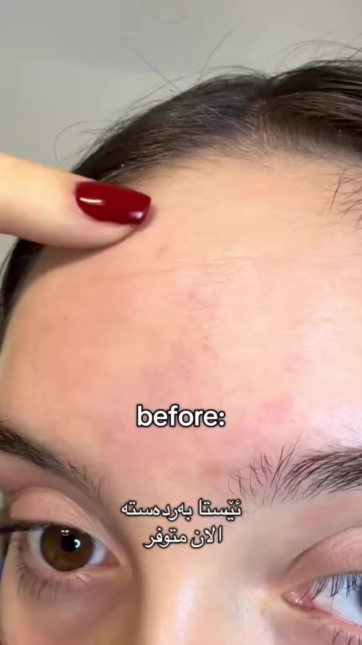 t Tightening Booster، وهو سيروم/بوستر يحتوي على Retinal 
(مشتق قوي من فيتامين A) مخصص لشد البشرة وتحسين مظهر التجاعيد والخطوط الدقيقة.

ما فوائده؟
 • يساعد على شد البشرة وتحسين مرونتها
 • يقلل من التجاعيد والخطوط الدقيقة
 • يحفّز تجديد خلايا البشرة
 • يعطي مظهر بشرة أنعم وأكثر نضارة
 • مفيد لتحسين ملمس البشرة والمسام

⸻

كيفية الاستعمال (مهم جداً)
 1. استخدميه ليلاً فقط (لأن الريتينال يتأثر بالشمس)
 2. على بشرة نظيفة وجافة
 3. خذي كمية صغيرة جداً (بحجم حبة البازلاء)
 4. وزعيه بلطف على الوجه أو المناطق المطلوبة
 5. بعده مباشرة استخدمي مرطب لتقليل التهيّج

⸻

طريقة الاستخدام للمبتدئين
 • أول أسبوعين: مرتين إلى 3 مرات بالأسبوع
 • بعدها: ممكن زيادته تدريجياً حسب تحمّل البشرة

⸻

تحذيرات مهمة
 • ضروري استخدام واقي شمس صباحاً
 • قد يسبب احمرار أو تقشير خفيف بالبداية (شي طبيعي)
 • لا يُستخدم مع:
 • مقشرات قوية
 • أحماض مثل AHA/BHA في نفس الروتين
 • غير مناسب للحامل أو المرضع

عنوان-كلار-ديوان مول طابق الثاني
***********
***********
#kalar #instagram #instagram  #bag #Hermes #نەوروز #erbil_iraq #بغدادالعراق #kfry #هەولیر #karbala #khanaqin #kurd #kurdstan #baghdad #بغداد #خانقين #عراق #کەلار #گەرمیان #کفری
