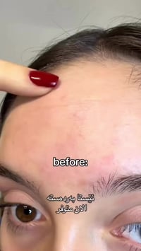 ريتينال • سيروم شد • مضاد تجاعيد