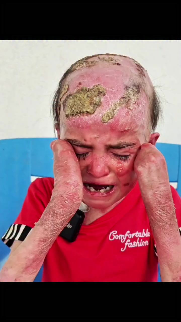 زكاة الفطر هي صدقة واجبة على كل مسلم (ذكر، أنثى، صغير، كبير) يملك قوت يومه تُخرج في نهاية رمضان وقبل صلاة العيد (ويجوز تعجيلها بيوم أو يومين) طُهرة للصائم ومواساة للفقراء. مقدارها حوالي (ألفين دينار عراقي لدى المذهب الشعي)و(ثلاث الاف دينار عراقي لدى المذهب السني)ويجوز إخراج قيمتها نقدًا 
سبعمائة واحد عشر طفل تحت رعاية مبادرتنا مبادرة الحياة للجميع 
نسعى إلى تقليل الأضرار لهؤلاء الأطفال الذين يعانون من أمراض داء الفقاع الجلدي وتحسين دور حياتهم وتوفير الحياة الكريمة لهم.
⭕لتسليم الزكاء حصراً التواصل عبر الخاص او رقم الواتساب 
***********
للمساهمة والتبرع لهم عبر المنافذ الاتية:
1️⃣تحويل الرصيد اسياسيل 
***********
2️⃣لتحويل الزين كاش
***********
3️⃣ماستر كارد الرافدين
تحويل ماستركارد 7947587882
تحويل سوبركي ***********

PayPal4️⃣
asal1994asal@yahoo.com

5️⃣للتحويل عبر مصرف العراق الاولfib
اوفيست باي او اسيا باي اوطيف باي
 عبر الرقم ***********
للتواصل عبر الواتساب 
***********
6️⃣كذالك تكَدرون تساهمون عن طريق ارسال صورة رصيد نوع اسيا عبر الخاص.

7️⃣وللتبرع من خارج العراق رابط منصة الكوفاندمي مثبت في بايو الحسابي.
⭕الخاص مفتوح الأسئلة والاستفسارات جميعاً

📌ارجوا مشاركة المنشور على صفحاتكم المحترمة كي يصل الى اكثر عدد ممكن وجزاكم اللّٰه اجر ناقذها.

#شارك_المنشور
#العراق #بغداد #اكسبلور #تصميمي iraq
