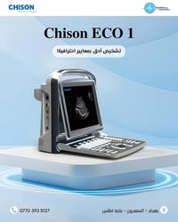 #الانسب_سعراً #تحدث وصار مع #دوبلر  جهاز السونار موديل #ECO1 متوفر الا...