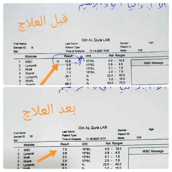 تتواجد كل يوم ثلاثاء مساءً 

#العنوان الحويجه /شارع الاطباء مجمع الحكمه الطبي 
الفرع الثاني مقابيل مجمع القمه الطبي 
للحجز والاستفسار ***********
متواجدين واتساب ***********
