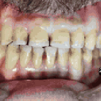 ✨ تنظيف الأسنان مو بس تجميل ✨ • يشيل الجير والتصبغات. • يحمي اللثة من ...