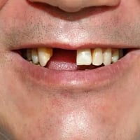 طالبة طب أسنان مرحله رابعه اللي عنده هيك حاله او احد من اقربائه ويريد ...