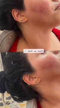 الحريه الزراعي • عروض العيد • صالون الجميلات