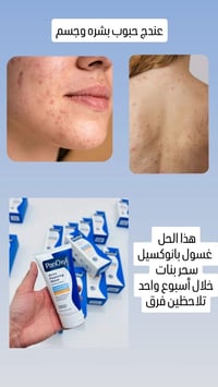 غسول • بانوكسيل • علاج الحبوب