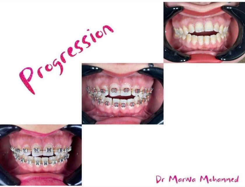 تقويم الأسنان 
د. مروة محمد طالب 
للتواصل ع الرقم
***********
