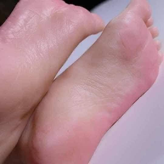 كريم كرم جي الايرانية الاصلية لازالة التشققات القدم والجلد الميت


**إذا كنت صاحب هذا الإعلان وتريد حذفه لأي سبب، رجاءا أرسل رسالة إلى الدعم الفني**