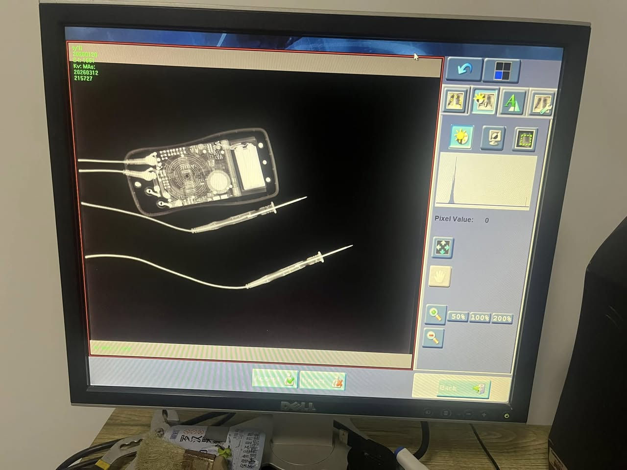 Portable X-ray machine
Carestream Vita LE CR system 
whatsApp ：+86 18931162541 

#SurgicalImaging #Fluoroscopy #OperationTheatre
#OrthopedicSurgery #SpineSurgery #PainManagement
#MedicalDevices #MedicalEquipment #HospitalEquipment
#UsedMedicalEquipment #MedicalEquipmentForSale
#Xray #DigitalXray #Radiology #DiagnosticImaging
#CTScan #MRI #Ultrasound
#Doctor #Hospital #healthcare 
#hitachi #fujifilm #shamidzu 
#importedequipment  #usedequipmentforsale


**إذا كنت صاحب هذا الإعلان وتريد حذفه لأي سبب، رجاءا أرسل رسالة إلى الدعم الفني**