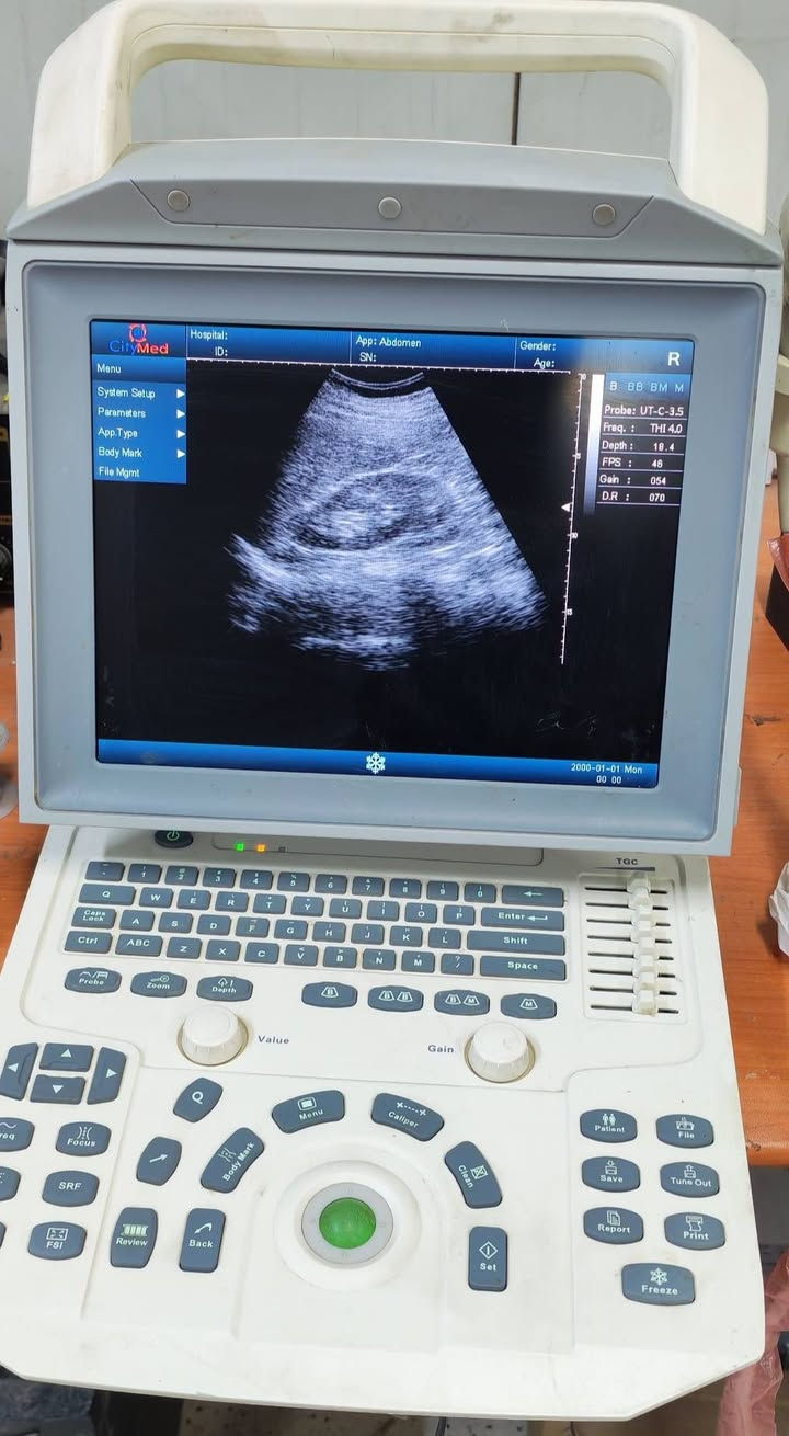(( جهاز سونار للبيع ))
- جهاز سونار نوع citymed مستعمل وبسعر مناسب جدا ...
 & اطبائنا الكرام &
- يوجد لدينا جهاز سونار مستعمل :-
اسم الجهاز :  citymed
سنة الصنع : 2022
المنشا : ايطالي
الملحقات : بروب convex 
نوع الجهاز : 2D  
مع جميع فحوصات
حالة الجهاز : ممتاز
وضوح الصورة : ممتاز
- للحجز والاستفسار يرجى مراسلة الصفحة او الاتصال على الرقم التالي :-
***********
وبسعر جدا جدا مناسب 💥💥

#أجهزةطبيةمستعملة #أجهزةسونار #سونار #اجهزةطبية #سونارمستعمل #سونارات #سامسونك #اجهزةطبيةجدبدة #اشعة #اشعةوسونار #اطباءسونار #سونرات #مهندس #sonoace #مستلزمات #طبية #فيلد #جل #كونفكس #فجاينل #لينير #4D #ob #gyn #abdomin #ايكو
#adaltecho #exam #GE #volusionp8
