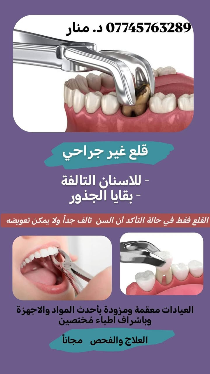 يتوفر علاج بحشوة ضوئية للحالات الاتية
العلاج مجاني و بأشراف اطباء مُختصين 
 في عيادات كلية السلام 
للتواصل ***********
