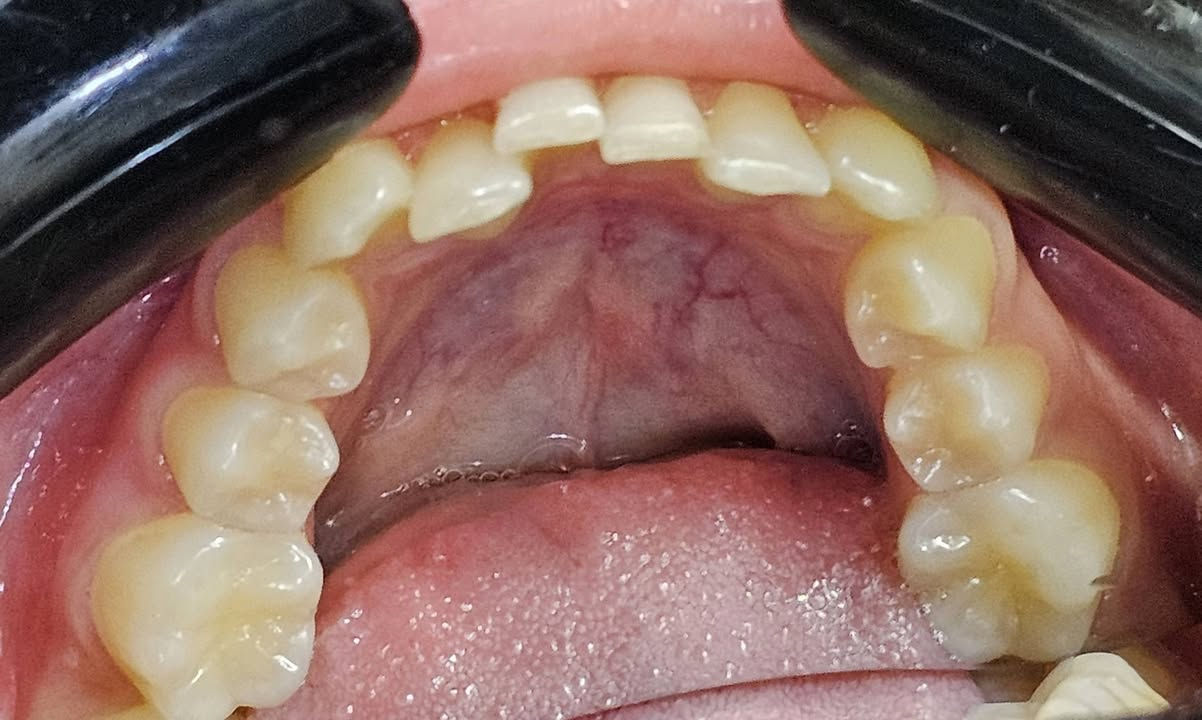 فاطمة اجتنة عدها اسنان لبنية وعدهة سن مطمور ضاحك وعدها الناب الدائمي صاير بالمقدمة وسنين اماميات راجعات ليورة خلال سنة وثلاث اشهر كدرنة نحل اغلب هاي المشاكل 

العنوان / المسيب / شارع البلدية / مقابل دكتور جعفر وفي للاطفال مجاور عالم الحليب

للحجز والاستفسار 
***********
***********
