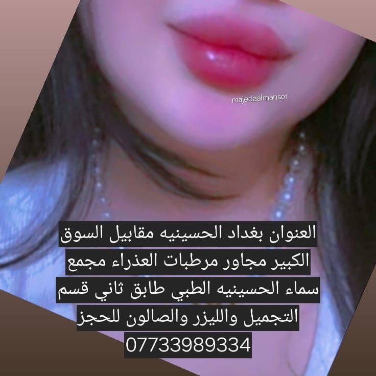 شفايف ممتلئة وطبيعية تخلي جمالج يبين من أول نظرة 💋
فيلر الشفاه عندنا بلمسة ناعمة ونتيجة تفتح النفس ✨
  الدكتورة ماجدة المنصور Jojo Alnabeel 
العنوان بغداد الحسينية مقابل السوق الكبير مجاور مرطبات العذراء
مجمع سما الحسينيه للطابق الثاني قسم التجميل والصالون ***********
