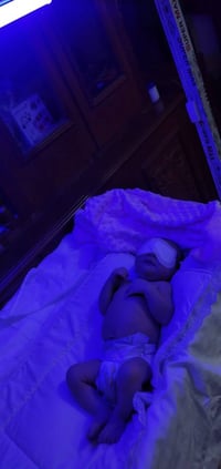 طفلك بيه ابو صفار ونسبتة صاعده ومحتار بدخوليته للمستشفئ  صار يمنه لمبا...