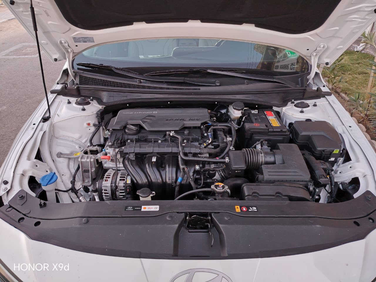 النترا 24
فول مواصفات لمتدد

حادثا بسيط 

فتح سقف
 
رادار 

كامرات 360

سياره زيرو بعده 

السعر 180 وبيه مجال بسيط 

العنوان بصره حي المهندسين

الاستفسار ***********
