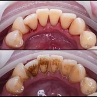 تنظيف اسنان • خلع جذور • تركيب اسنان متحرك