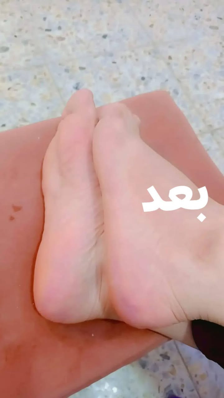 #صالون #ريماس
#العبيدي #شارع ٢٠ مجاور اسواق الرحمن مقابل عيادة الفهد
تنضيف قدم ترجع بيبي ناعمه 😍
واتساب  ***********
