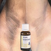 تفتيح البقع • كلف ونمش • توصيل لجميع المحافظات