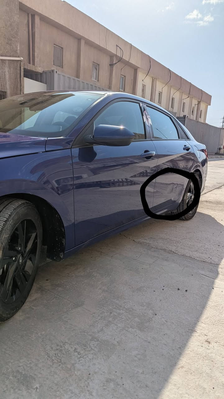 السلام عليكم
النترا 22 وارد امريكي حادثها واضح كدامكم بدون ايرباك حادث خلفي جاملغ ايسر فقط انا مستوردتها رقم اربيل بسمي شرط تحويل داخلة بنهاية 2024 شهر 10 بيها بارد باب خلفي ايسر وايمن موضحهم بالصور كلش خفيف يعني كحته بسيطة ماشية 83الف كيلو وقابل لزيادة مواصفات sel بصمة تشغيل وابواب بدون فتحه شاشة وعينه عادية كلشي بيها بلاد كير ومكينة راديتر وماي راديتر كلها بلاد.
لا حماوه ولا دوانس
لايت زنون وتايرات جدد وباتري جديد .
بيها صبغ دعامية خلفية وجاملغ خلفي نفسه مصلح ومصبوغ

السعر 150 ..واسف على الاطالة..مع تحياتي للجميع

التواجد بصرة/بغداد


**إذا كنت صاحب هذا الإعلان وتريد حذفه لأي سبب، رجاءا أرسل رسالة إلى الدعم الفني**