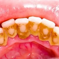 نهنئكم بحلول عيد الفطر المبارك، ونتمنى الكم عيد سعيد مليء بالصحة والعا...