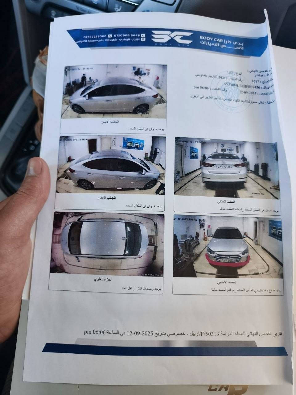 الانترا 2017 وارد امريكي رقم اربيل الجديد سياره نضيفه ومكفوله بس الي بل سونار وكامل موصفات ماعده لفتحه رقم*********** سياره سعرها 125 وبيها مجال
