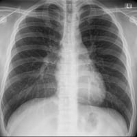 اخواني الاعزاء  تعلن عياده الربيع عن تخفيض كافه الفحوصات الشعاعيه لشهر...