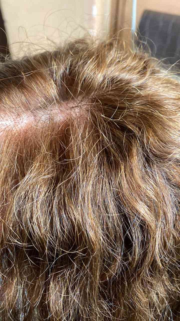 مرحبًا، باروكة شعر طبيعي ١٠٠٪؜ كيرلي، جديدة وممستخدمة ولا مرة واشتريتها اول البارحة والدليل هو المقدمة شوفوها شلون جديدة بعدها، + اشتريتها ب٢٥٠ الف بس اني حبيعها ب١٢٥ الف


**إذا كنت صاحب هذا الإعلان وتريد حذفه لأي سبب، رجاءا أرسل رسالة إلى الدعم الفني**