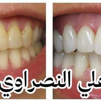 � عروض العيد المميزة مع د. علي حسين النصراوي العبادي 🦷✨  بمناسبة عيد ا...