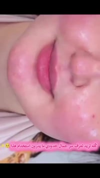 كريم فلر • تبييض وتسمين • توصيل