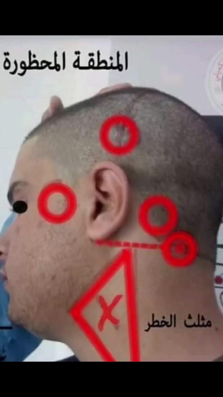 حجامه وعلاج بدودة العلق وسم النحل وغصن الحياة
حسب الحالات المرضية للرجال للنساء والأطفال الاصلاح قرب مولد نوري وتوصيل لباب البيت بغداد فقط حجز واستفسار***********
