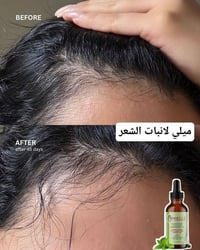 قطرات ميلي • روزماري • تكثيف الشعر