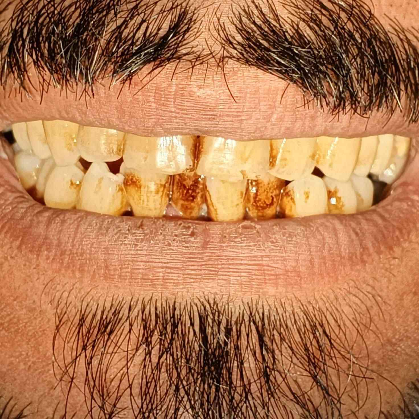 حي البساتين قرب مرطبات كريم سفيح
الدكتور حاتم مالك فوك المظمد السيد جابر *********** وهذا رقمي العياده @الجميع
