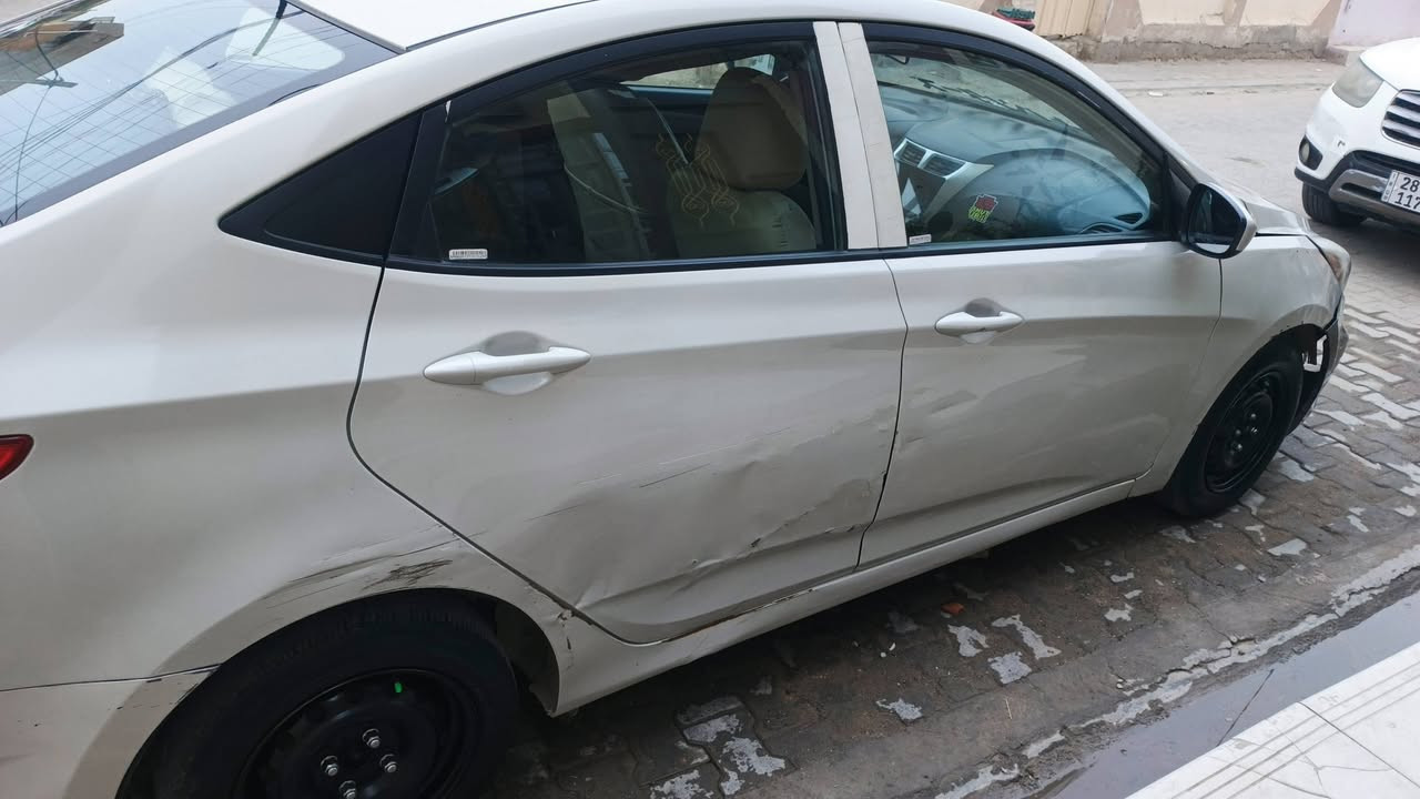 للبيع اكسنت 2017 ضربه بالباب خفيفه زائد بنيد عايز لها تبديل دعاميه السعر 85 بيها مجال بس الشراي يتصل يتواصل على الصفحه


**إذا كنت صاحب هذا الإعلان وتريد حذفه لأي سبب، رجاءا أرسل رسالة إلى الدعم الفني**