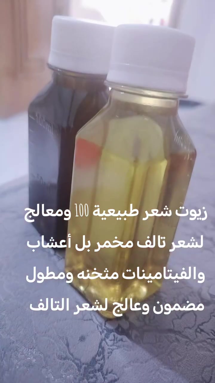 السلام عليكم بنات اوفر زيوت طبعيه
لعلبه ازغير سعره 10 وتوصيل مجاني
العلبه الحجم الكبير سعره 15 وتوصيل مجاني
اذا ماستفاديتي ترجع فلوسج امانه حته للحامل وآل أطفال مضمونه 
اسلام عليكم بنات اوفر زيوت شعر طبيعية 100 مطول ومعالج لشعر تالف مخمر بل أعشاب والفيتامينات مثخنه


**إذا كنت صاحب هذا الإعلان وتريد حذفه لأي سبب، رجاءا أرسل رسالة إلى الدعم الفني**
