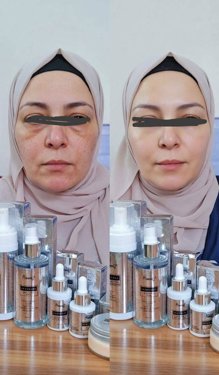 🍋✨ مجموعة اللومي من HÖM – سر البشرة الصافية والمفتحة ✨🍋
إذا عندك:
• مسام واسعة 😣
• بهتان وعدم توحيد لون
• إفراز دهون زائد
• آثار حبوب خفيفة
هاي المجموعة معمولة إلك 💛
💎 شو بتعمل؟
✔️ تفتح وتوحد لون البشرة تدريجياً
✔️ تساعد على تضييق المسام وتقليل مظهرها
✔️ تنظف بعمق وتزيل الدهون المتراكمة
✔️ تعطي إشراقة ولمعة صحية من أول استخدام
✔️ تترك البشرة ناعمة ومشدودة
🍋 خلاصة اللومي بتنقي البشرة وبتعطيها انتعاش فوري
🍋 تحسي ببشرتك أخف وأنعم من أول أسبوع. #لطلب. #شحن متوفر. #سوريا. #تركيا. #العراق. #لبنان. #السعوديه. @إشارة


**إذا كنت صاحب هذا الإعلان وتريد حذفه لأي سبب، رجاءا أرسل رسالة إلى الدعم الفني**