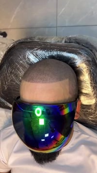 Ahmed smp  كل هذا بثلاث جلسات فقط‼️ من اليوم بعد متحتاج اي مواد مكثفة ...