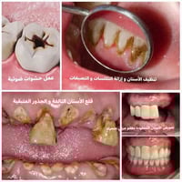 الي محتاج تنظيف، قلع ،حشوات ،طقم يتفضل يتواصل معي وآني اتفق معه  العلا...