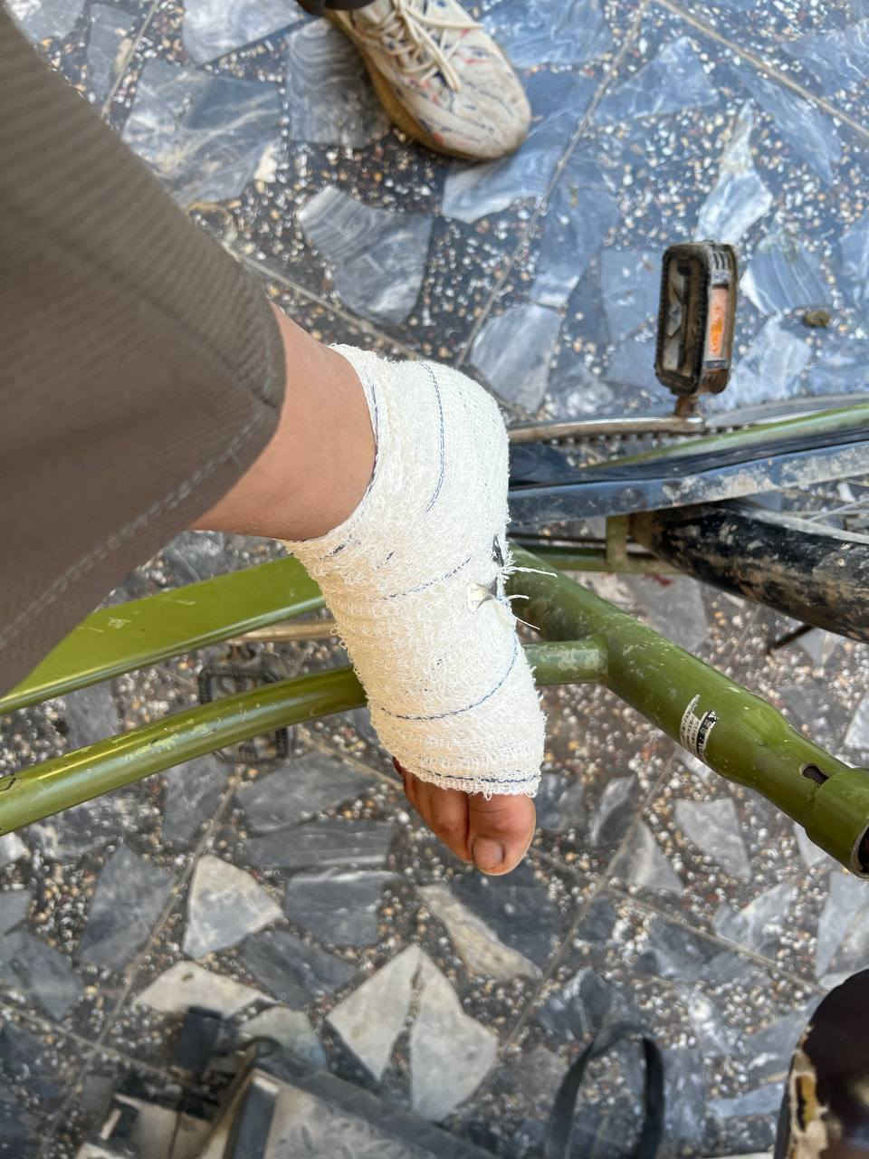 سلام عليكم باسكل جبلي ياباني بي ضربات بسيطه سبب البيع انشكت رجلي وبعد ما اكدر استخدمه 
السعر 50 ولشراي بي مجال العنوان بغداد بلديات


**إذا كنت صاحب هذا الإعلان وتريد حذفه لأي سبب، رجاءا أرسل رسالة إلى الدعم الفني**