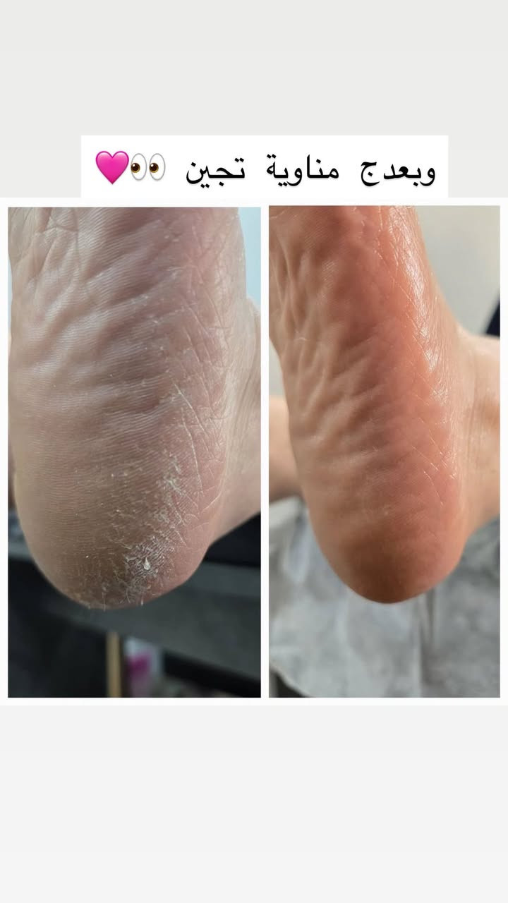 تردين مركز يدلعج وينطيج الي تستحقي من اهتمام ونضافة احنا موجودين كل ايام الاسبوع😎😍🤎)للحجز والاستفسار ***********
