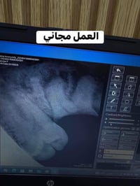 طبيب أسنان • قلع جذور • الحله شارع ٤٠