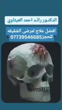وأخير الحل الوحيد لمرضى الشقيقه(البوتكس) مع الدكتور رائد العيثاوي استا...